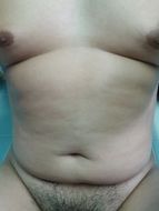 แชท ask, หญิง 