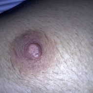 แชท ask, หญิง 