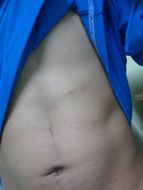 แชท กระเทย 