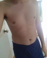 แชท แชทสด 