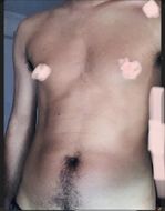 แชท หากิ๊ก, แชทเปิดกล้อง 