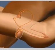 แชท หาเพื่อนคุย, แชทเปิดกล้อง 