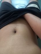 แชท แชทเปิดกล้อง 