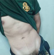 แชท หาเพื่อนคุย, หากิ๊ก 