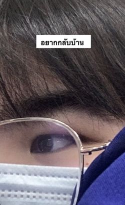 รูปภาพที่โพสต์โดย 🍀มะลิรักแมว🍀 หัวเข่าที่3