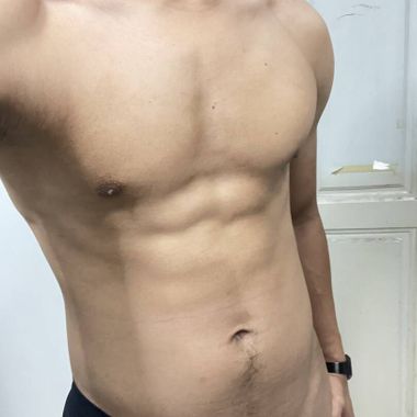 แชท หากิ๊ก 