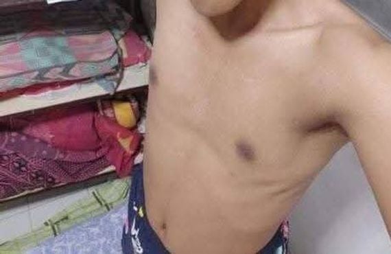 แชท ไบรุก