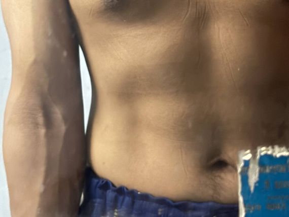 แชท หญิง, ไบ 