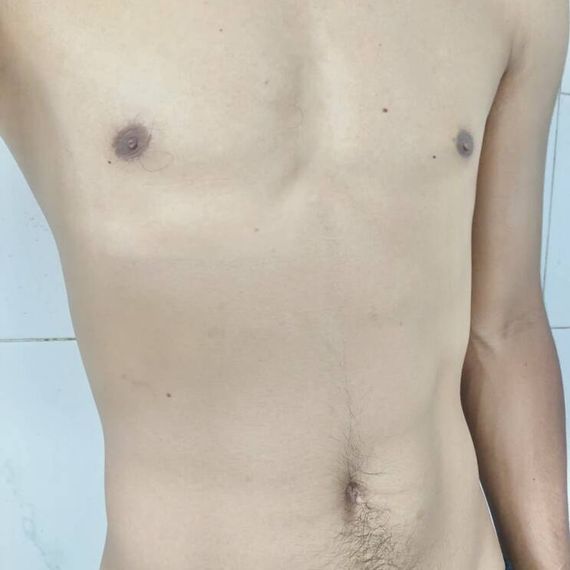 แชท ask, หญิง 