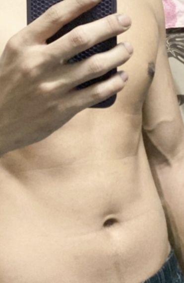 แชท หญิง, ควีน 