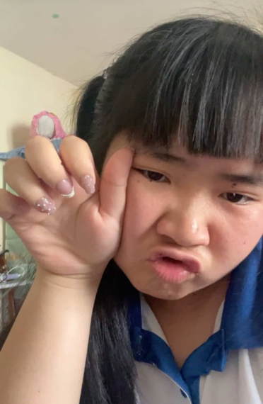 แชท กระเทย, ไบ 