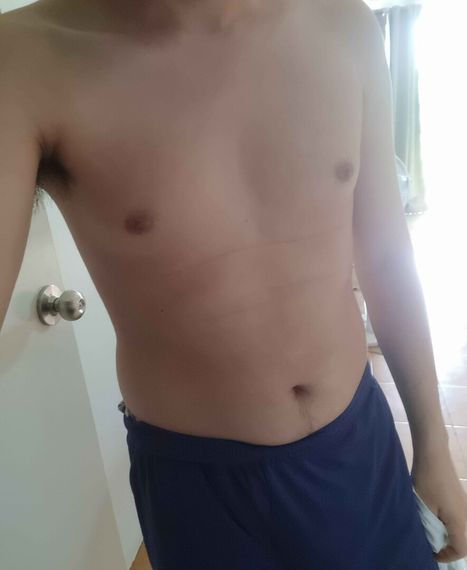 แชท แชทสด 