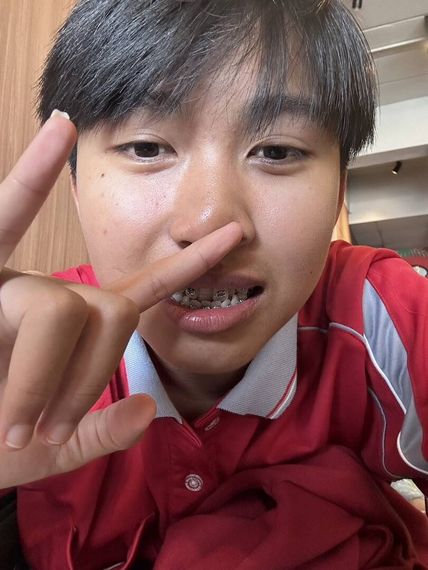 แชท แชทเปิดกล้อง 
