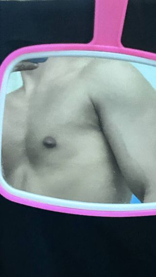 แชท หากิ๊ก 