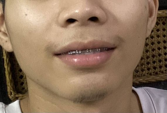 แชท แชทเปิดกล้อง 