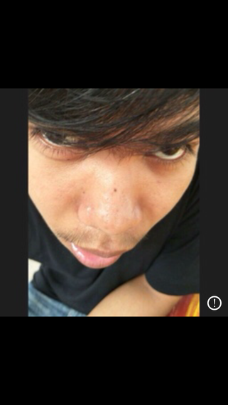 แชท หากิ๊ก, แชทเปิดกล้อง 