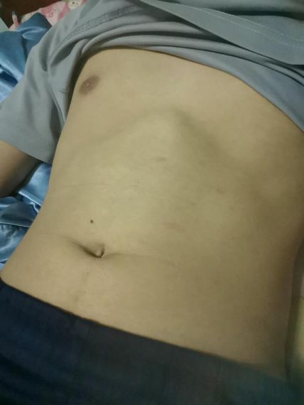 แชท หาเพื่อนคุย, โสด 