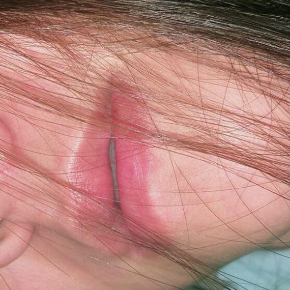 แชท หาเพื่อนคุย, โสด 