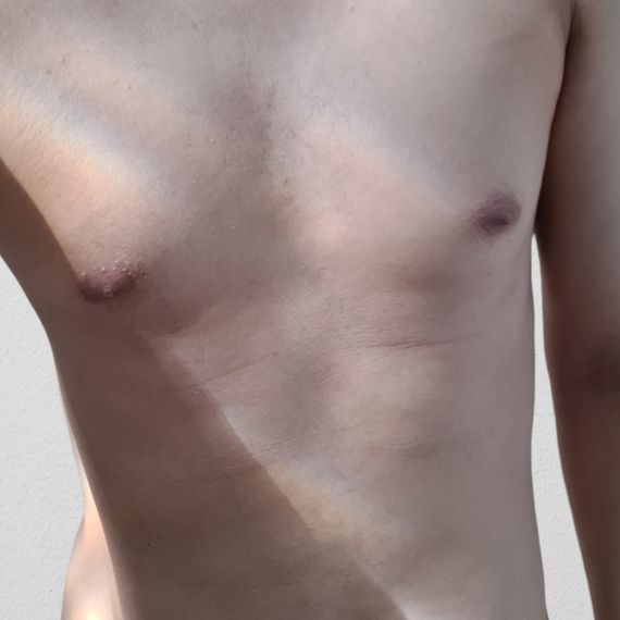 แชท โสด, แชทเปิดกล้อง 