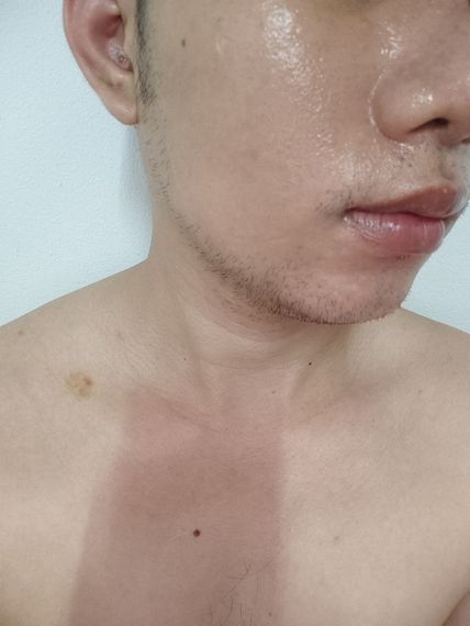 แชท หาแฟน, โสด 