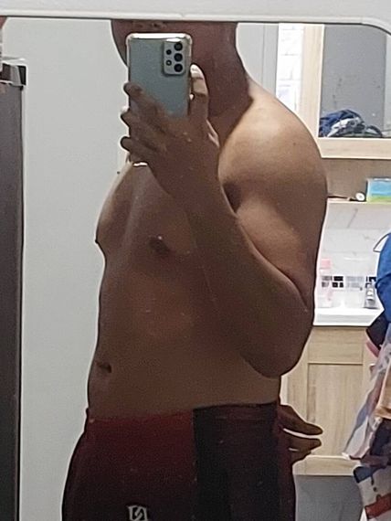 แชท โสด 