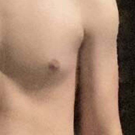 แชท หากิ๊ก 