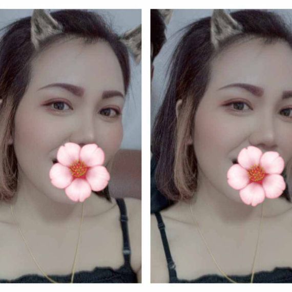 แชท โสด