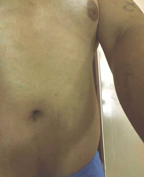 แชท หาเพื่อนคุย, โสด 