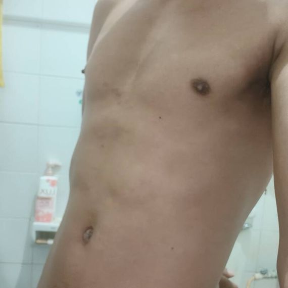 แชท โสด, หาเพื่อนไลน์ 