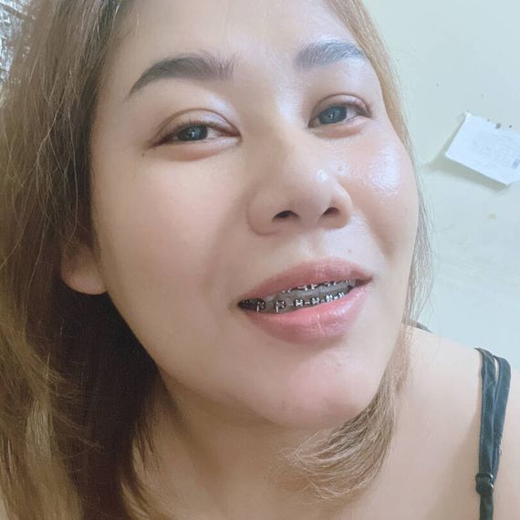 แชท หาเพื่อนคุย, โสด 