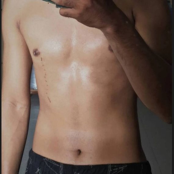 แชท หาเพื่อนไลน์, แชทเปิดกล้อง 