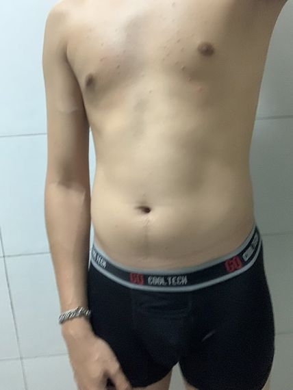 แชท หากิ๊ก, แชทเปิดกล้อง 