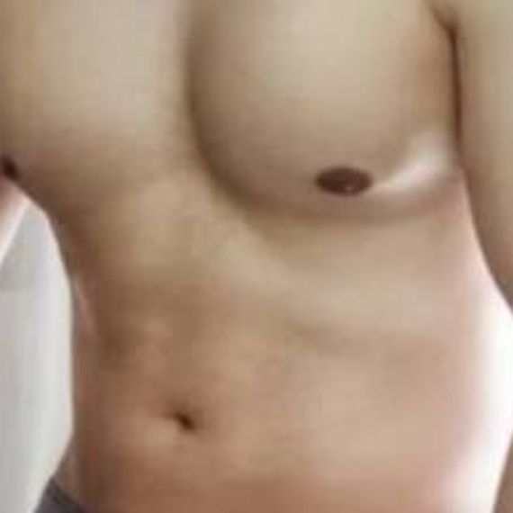 แชท หาเพื่อนไลน์, แชทเปิดกล้อง 