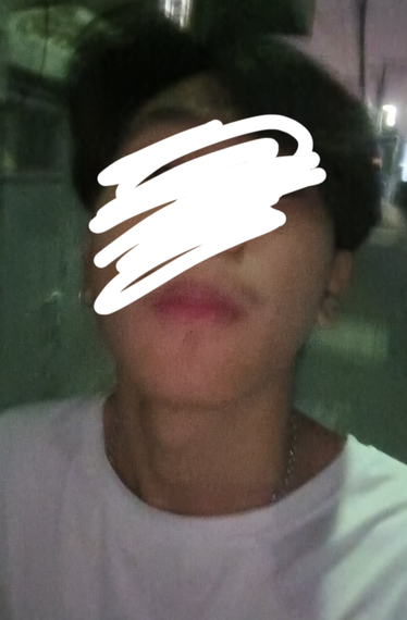 แชท หากิ๊ก 