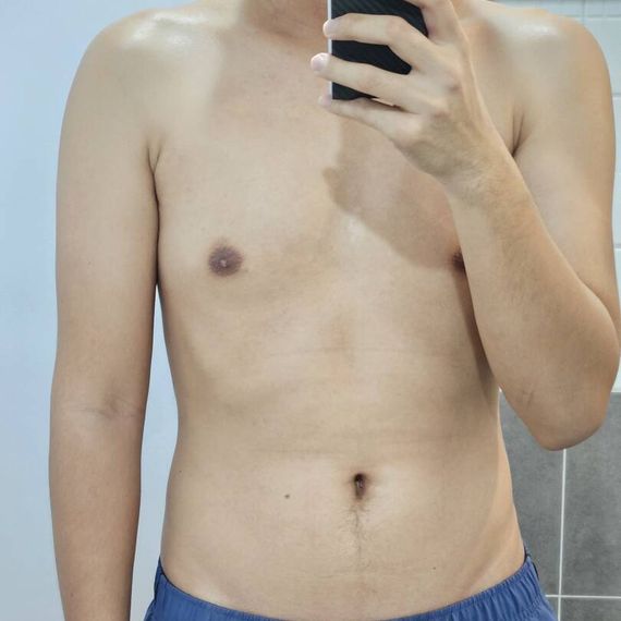 แชท หากิ๊ก 