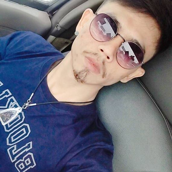 แชท หากิ๊ก 