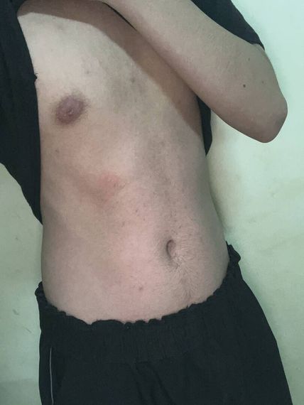 แชท โสด, แชทเปิดกล้อง 