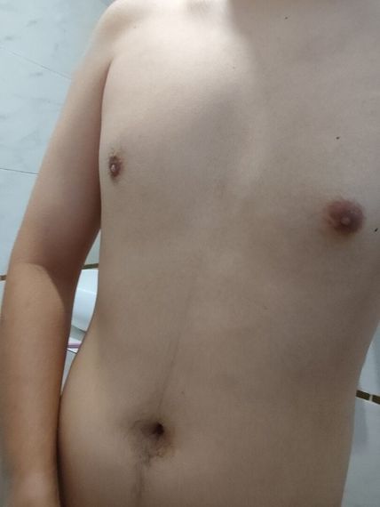 แชท โสด, แชทสด 