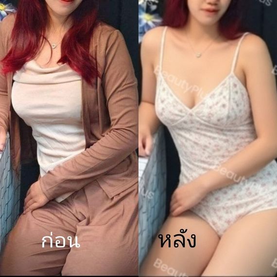 แชท นัดเจอ, ฟิวแฟน 