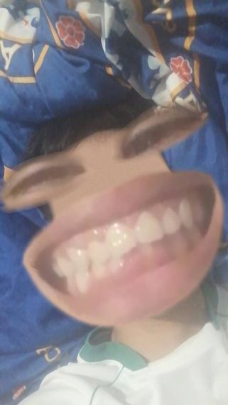 แชท หาเพื่อนคุย, โสด 