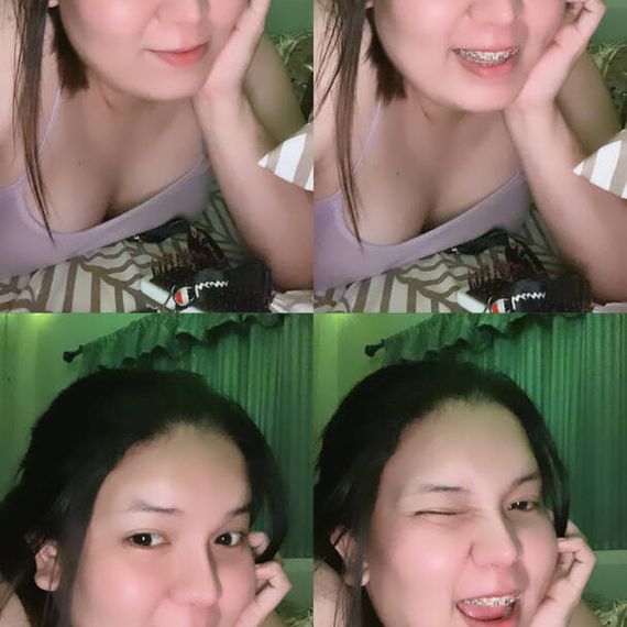 แชท หากิ๊ก 