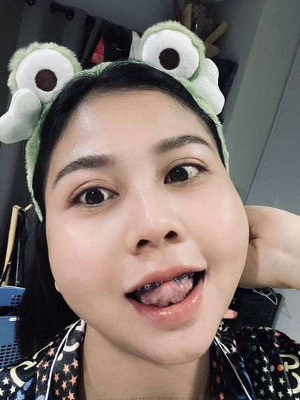 แชท หากิ๊ก 