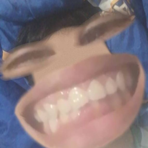 แชท โสด 
