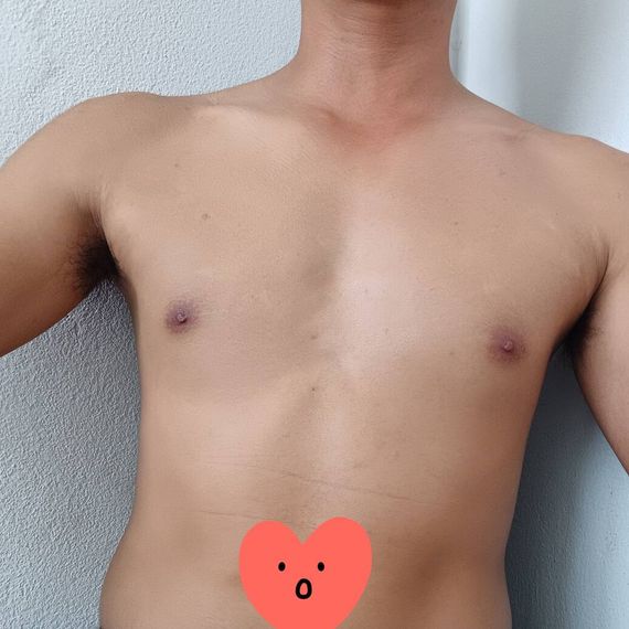 แชท หาเพื่อนคุย, แชทเปิดกล้อง 