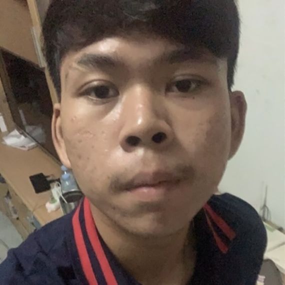 แชท โสด  ที่อยู่  ขอนแก่น