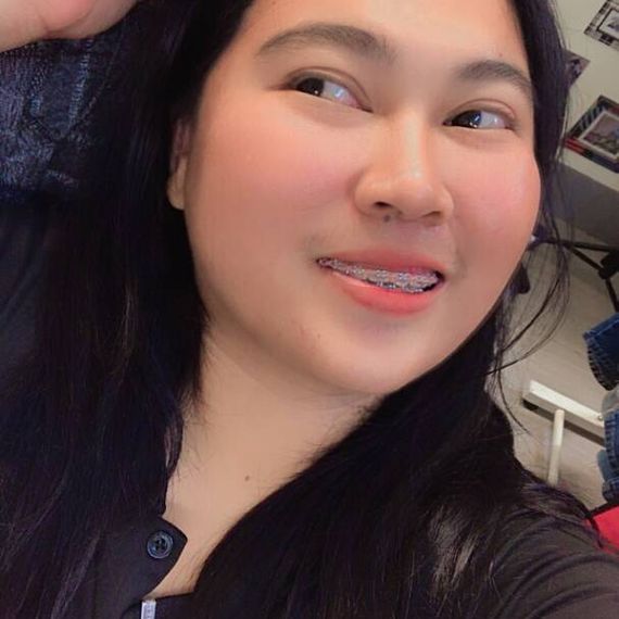 แชท โสด 