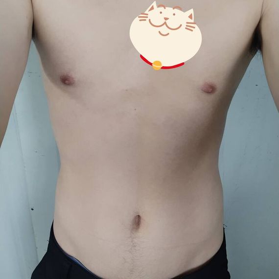 แชท โสด 