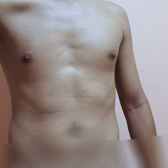 แชท หาเพื่อนคุย, แชทเปิดกล้อง 