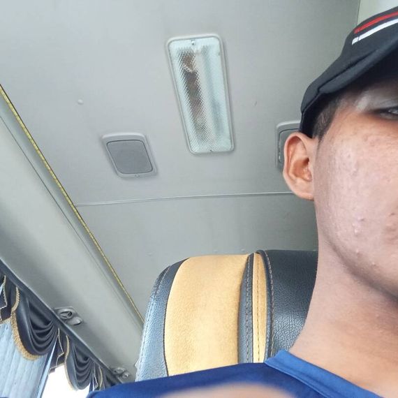 แชท หากิ๊ก