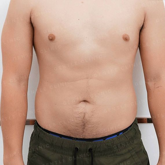 แชท หากิ๊ก 